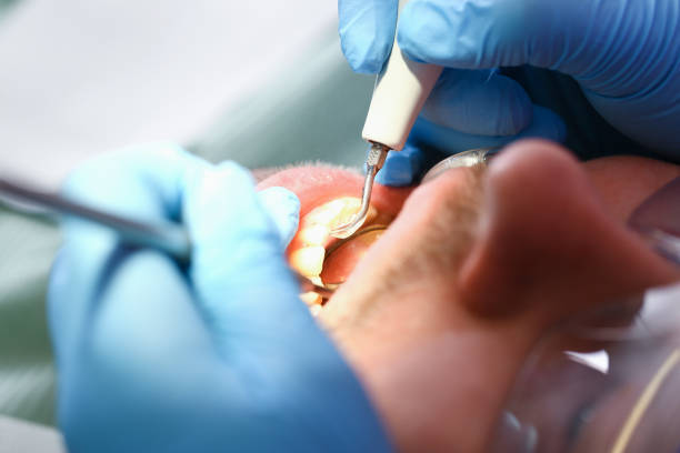 Best Broken or Cracked Tooth Emergency Dentist in Bakersfield, CA