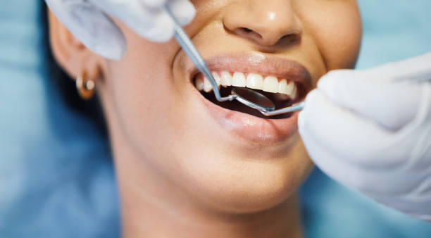 Best Emergency Dental Extractions in Bakersfield, CA